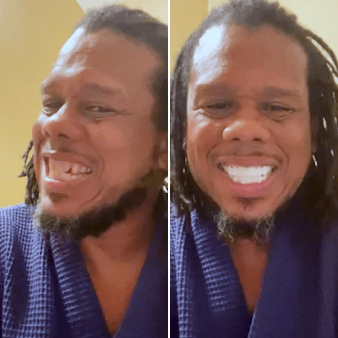 ¡BAM! ¡Puedo sonreír!