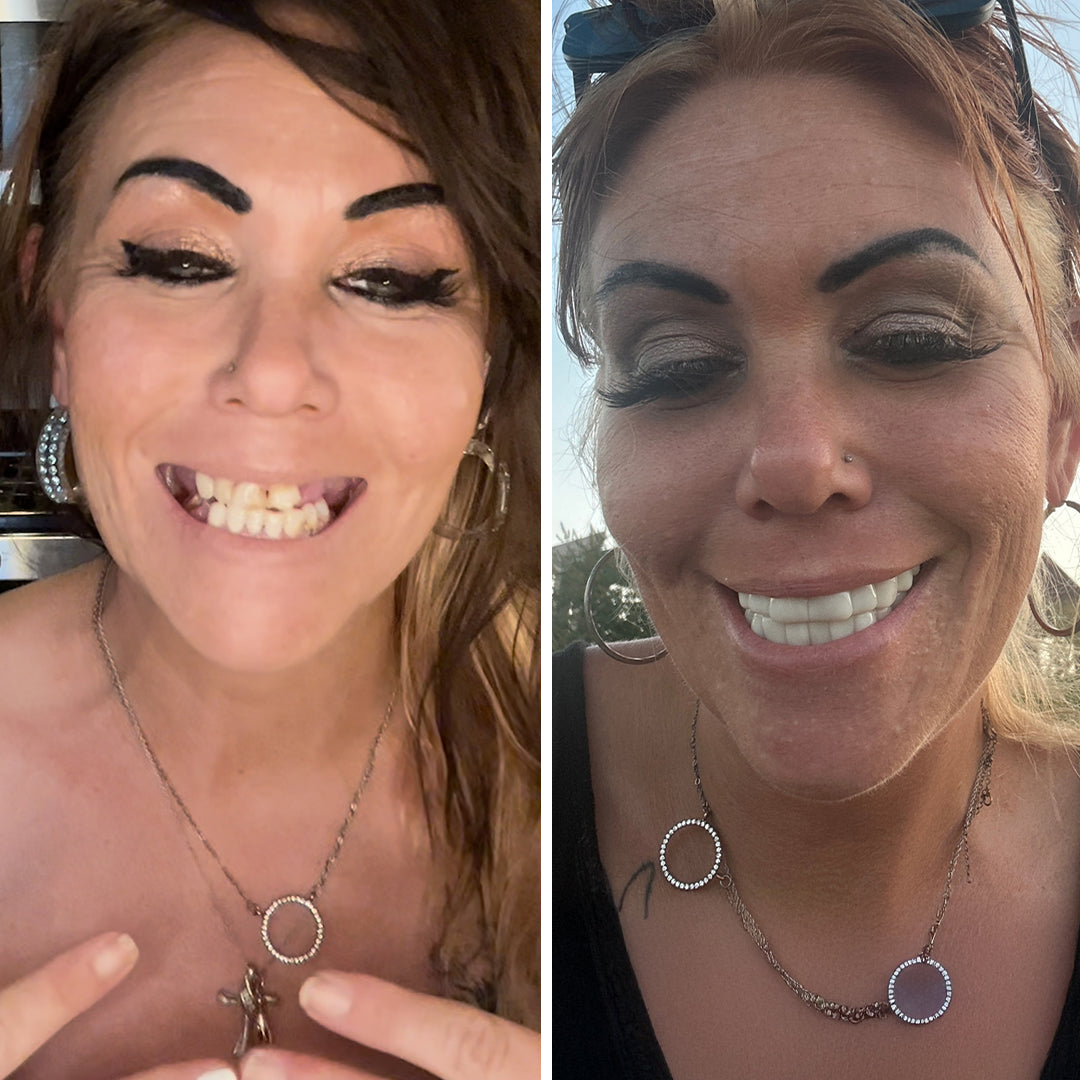 Estas chapas son un salvavidas