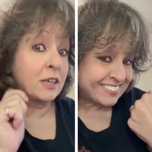 WOW ¡mira mi nueva sonrisa!