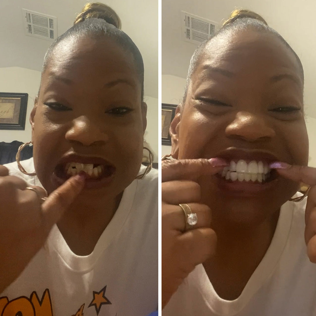 Una sonrisa que cambia el juego