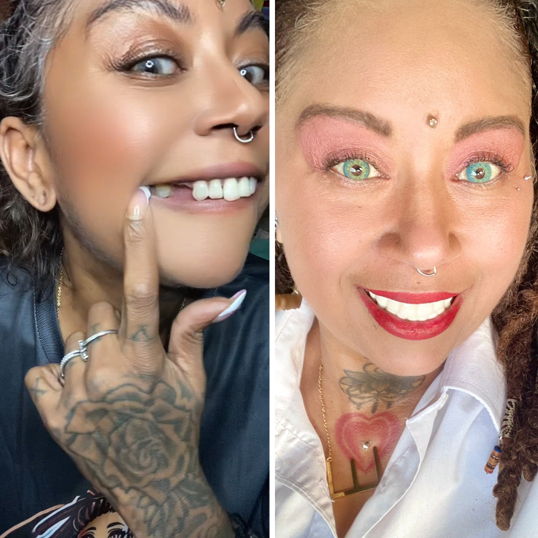 Proceso de sonrisa fácil e indoloro