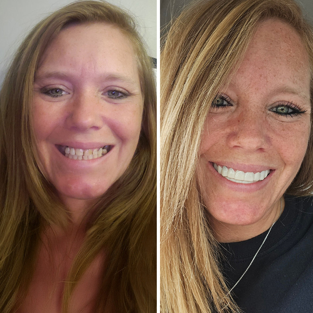 ¡Es tan fácil volver a sonreír!