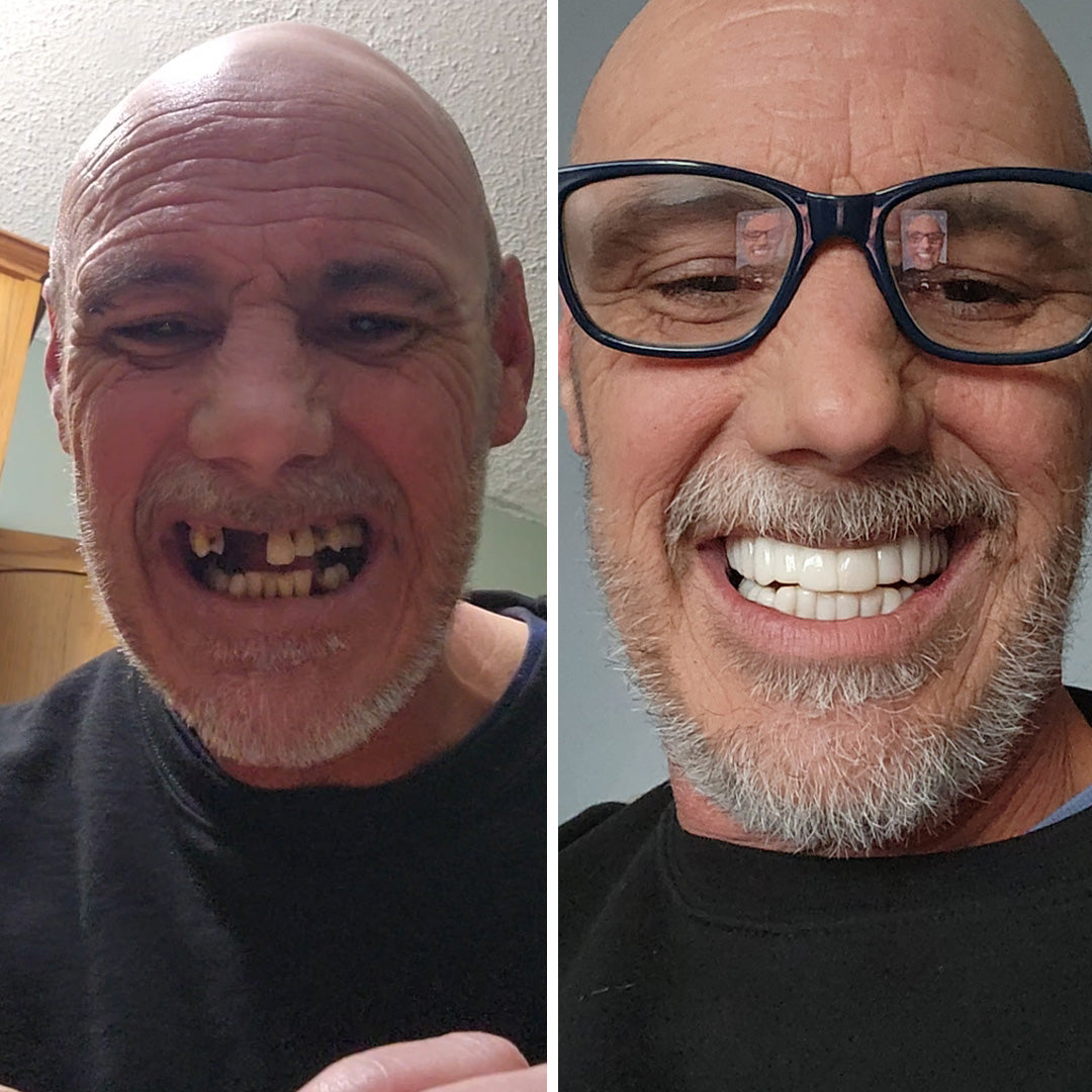 Estoy muy impresionado con mi sonrisa.