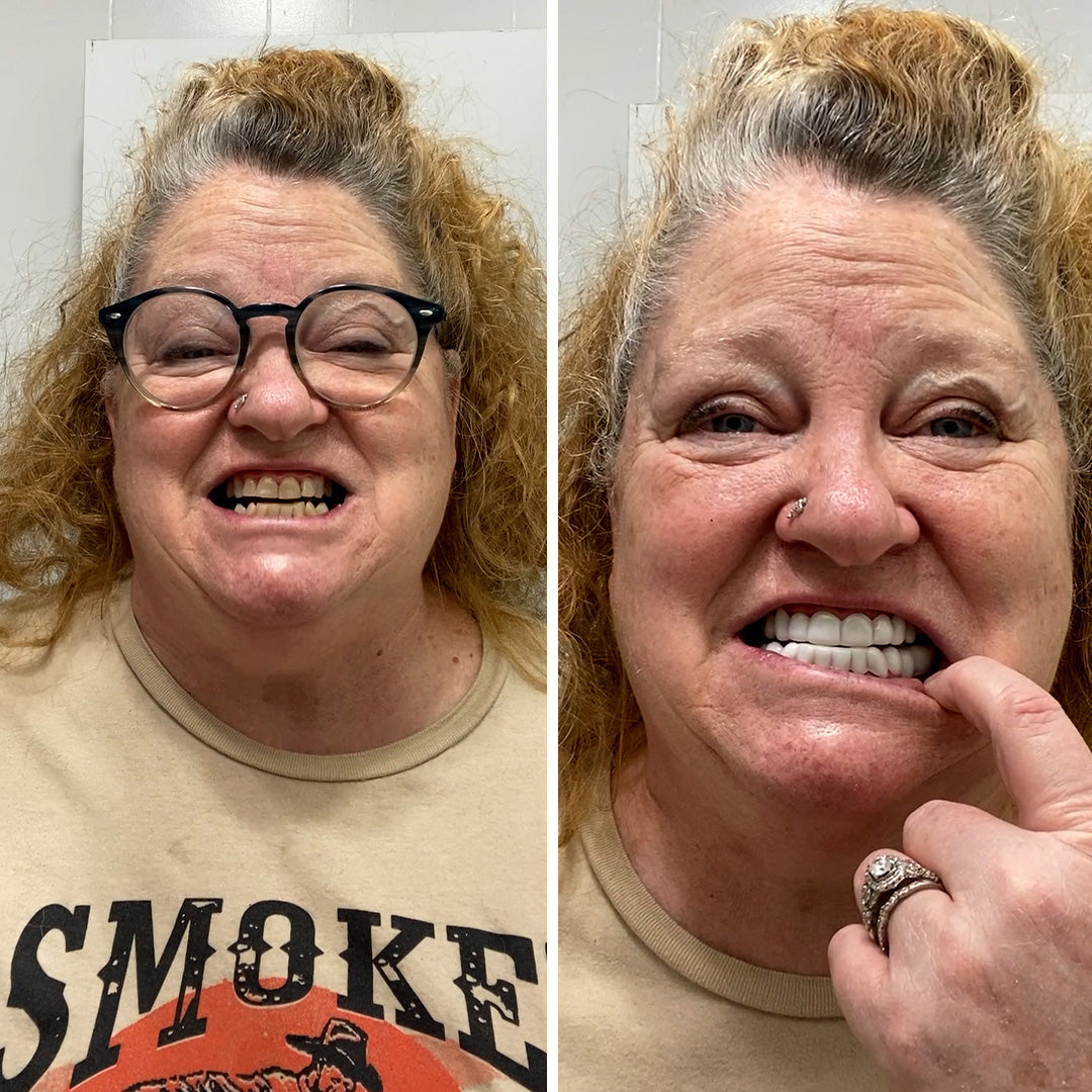 Hermosa sonrisa después de 34 años