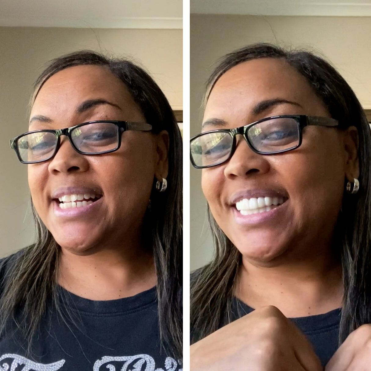 ¡Sin dolor, todo es ganancia! ¡Sonrisa perfecta!