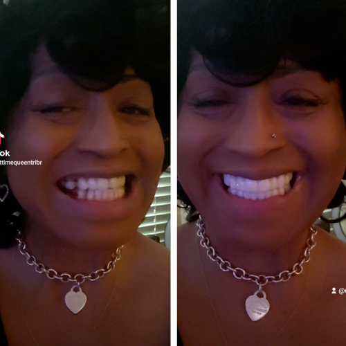 No pague miles de euros por su sonrisa.