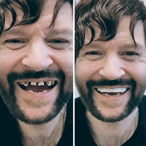 ¡Pop On tiene la mejor relación calidad-precio!