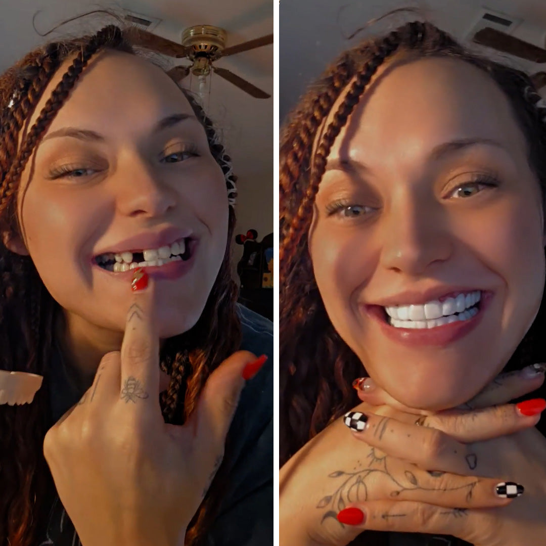 Se acabaron los dientes perdidos.