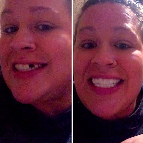 Es increíble volver a sonreír.