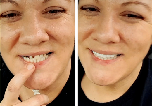 ¡Pop On merece la pena!