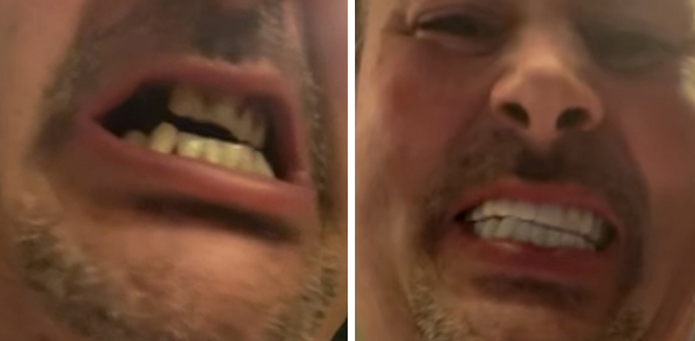 ¡Vaya! ¡Puedo sonreír de nuevo!