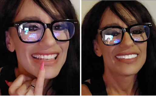 ¡Me encanta mi sonrisa!