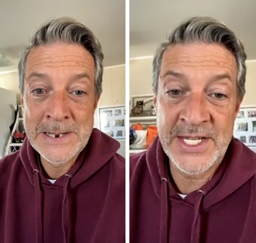 ¡Recomiendo totalmente Pop On Veneers!