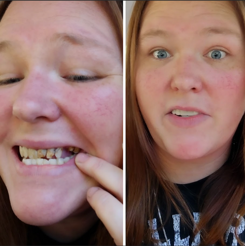 ¡Alucinado con estas chapas!