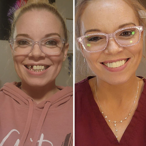 ¡Sonrisa increíble al instante!