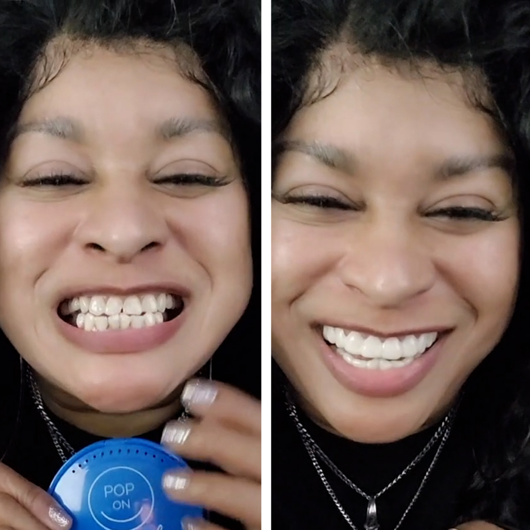 ¡Estoy TAN contenta con Pop On Veneers!