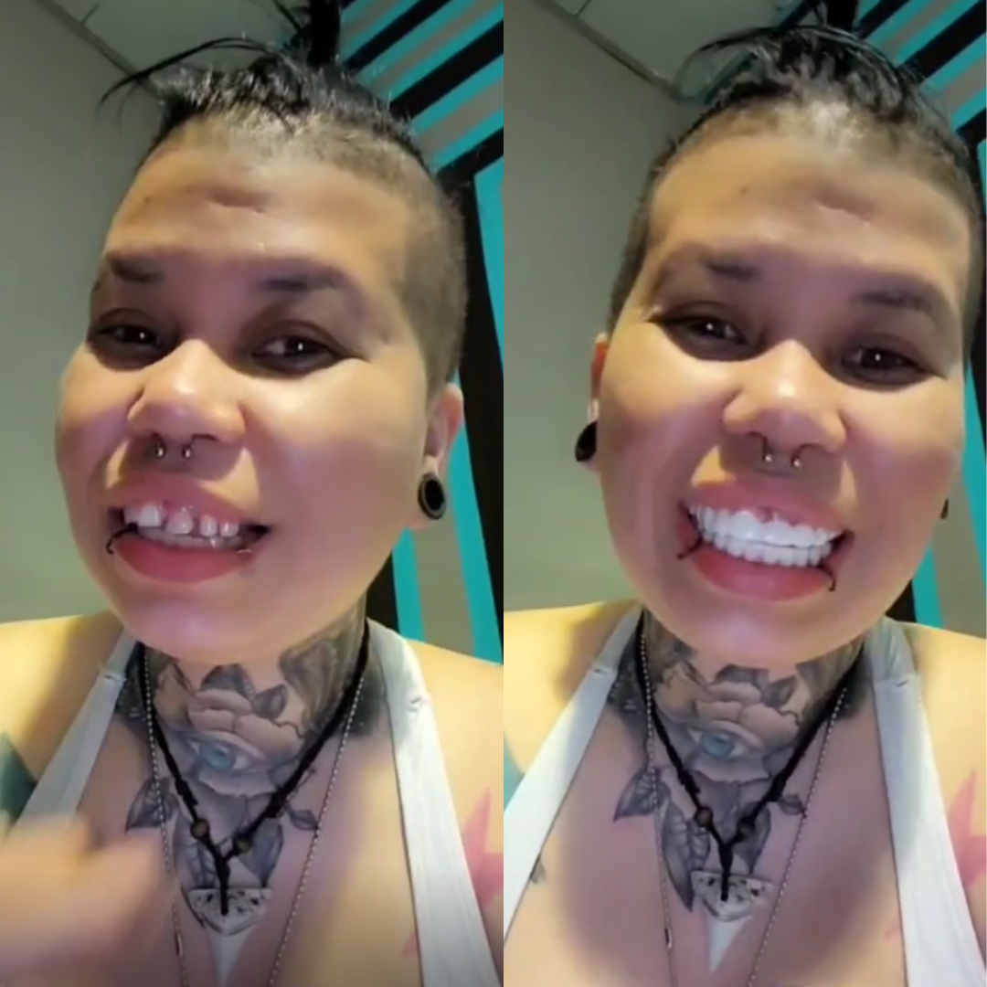 Simplemente chasquea literalmente los dientes