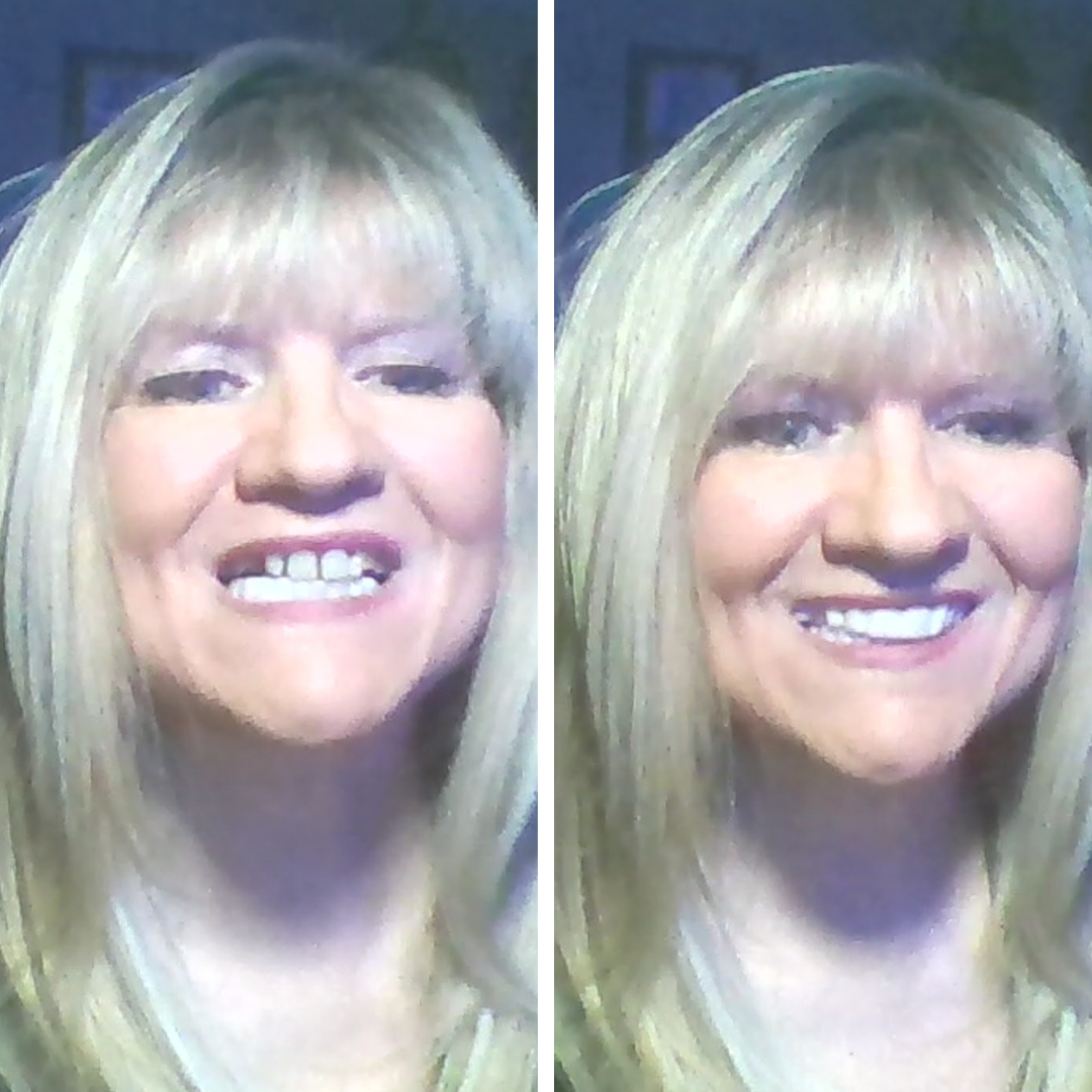 Me encanta mi sonrisa.