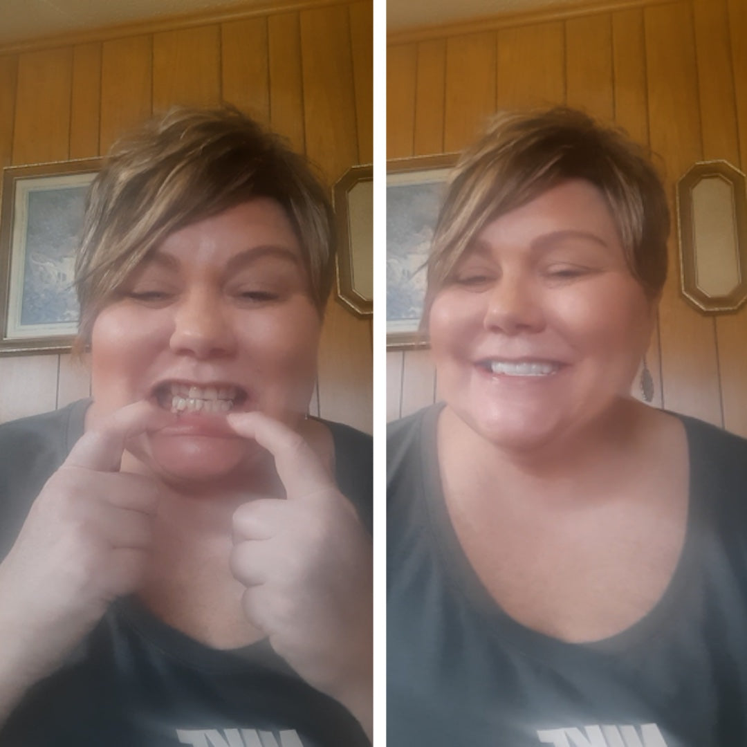 Mi sonrisa blanca de Hollywood