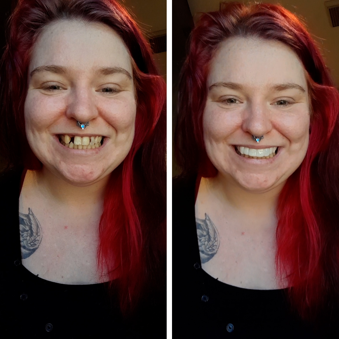 Sonriendo con confianza