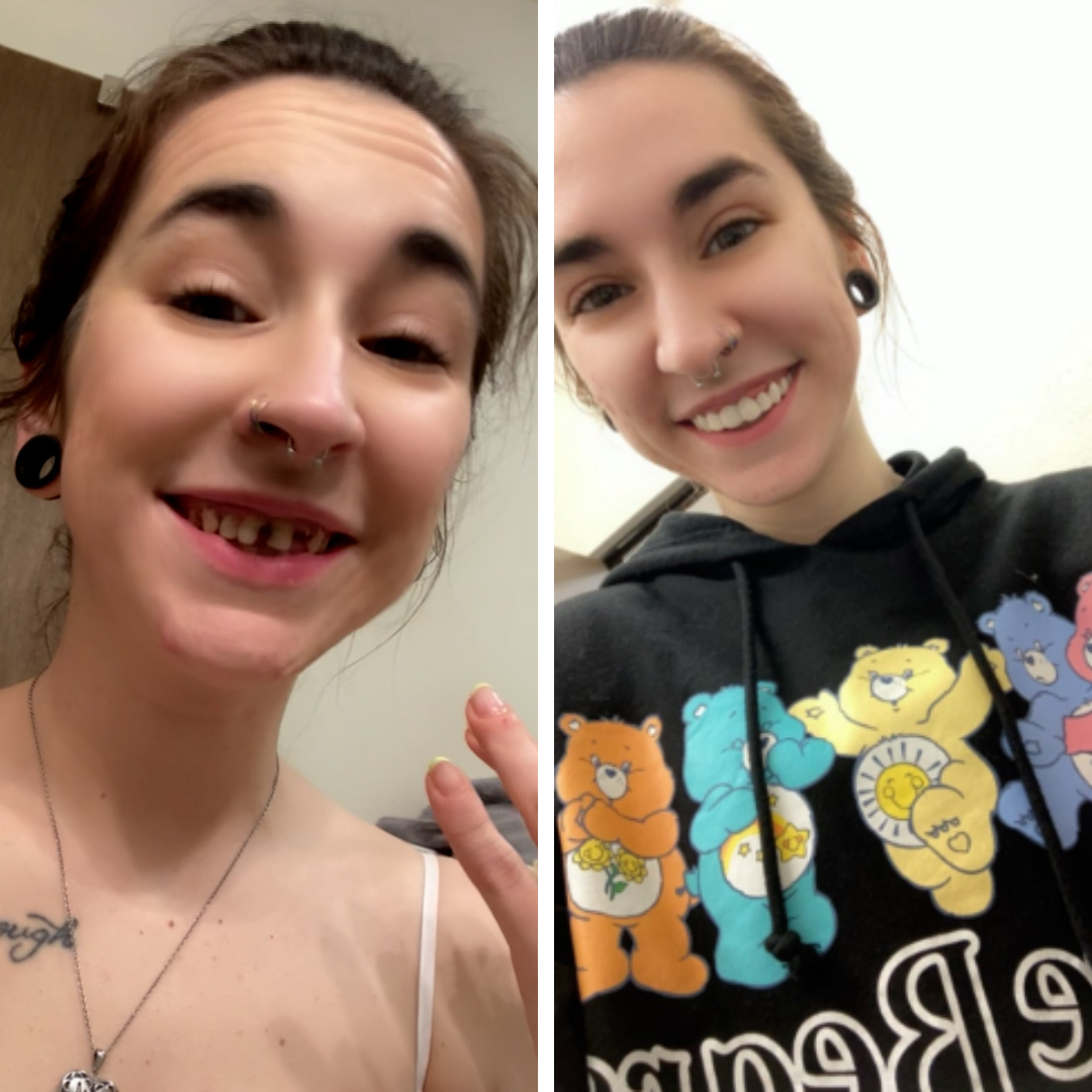 Estoy encantada con mi nueva sonrisa.