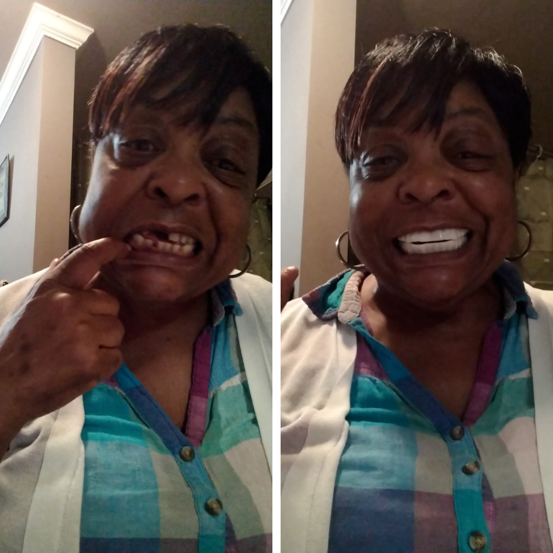 ¡Mira la diferencia!