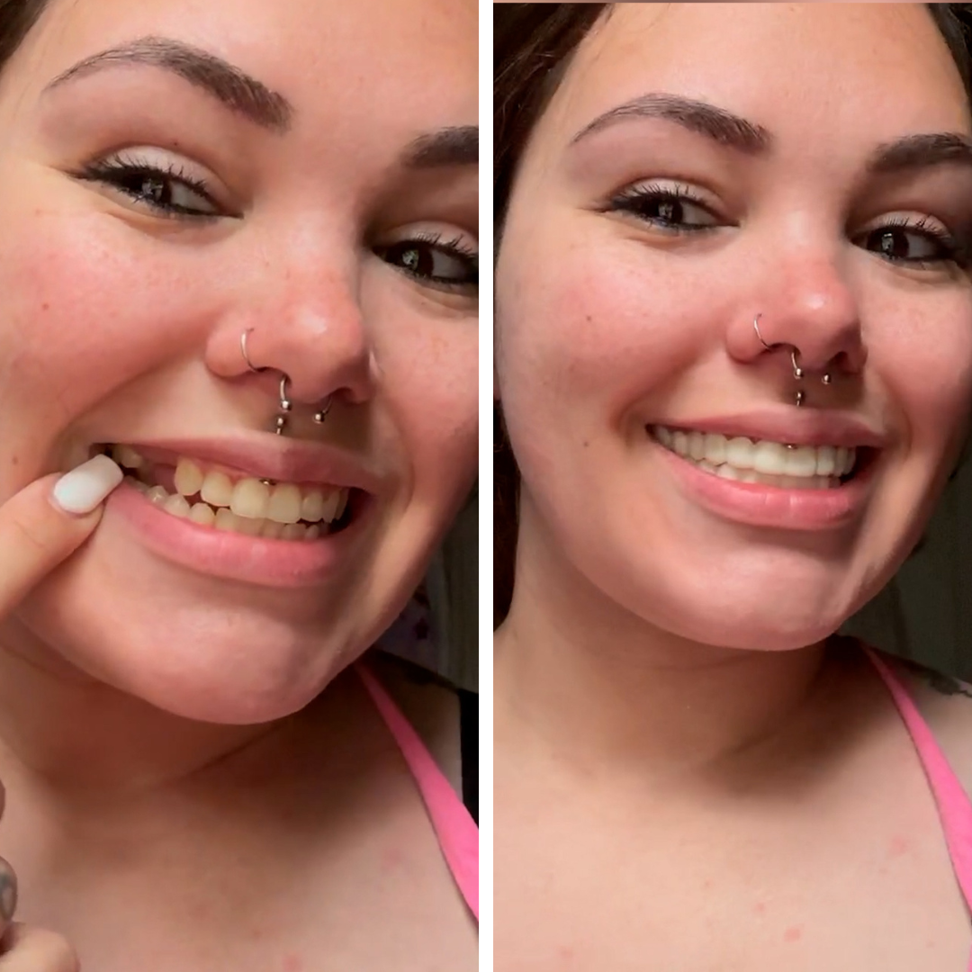 ¡Tan feliz con mi sonrisa!