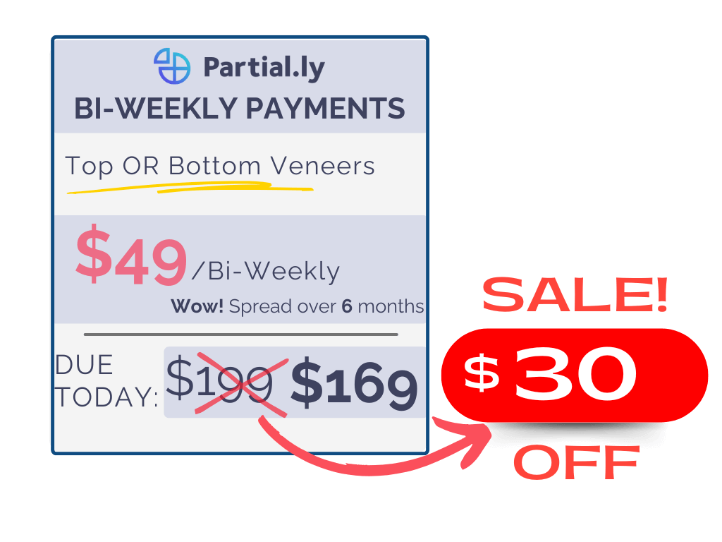 Bi-Weekly Payment Plan - Pop On Veneers with At Home Impression Kit - $30 Off