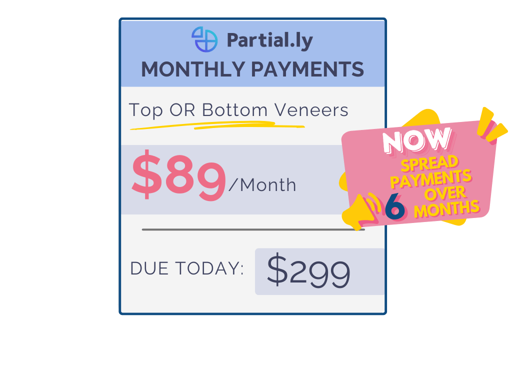Monthly Payment Plan - Pop On Veneers with At Home Impression Kit