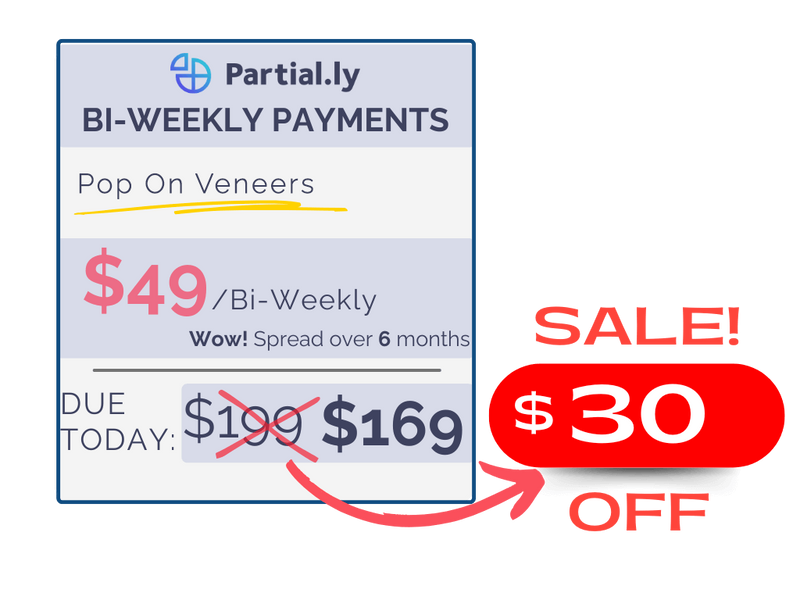 Bi-Weekly Payment Plan - Pop On Veneers with At Home Impression Kit - $30 Off