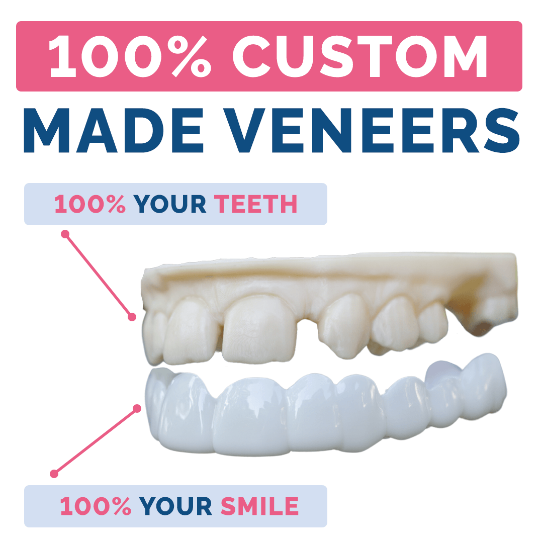 PDP_100_ CUSTOM MADE VENEERS.png