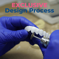 Add Opposite Arch After Veneers Delivered