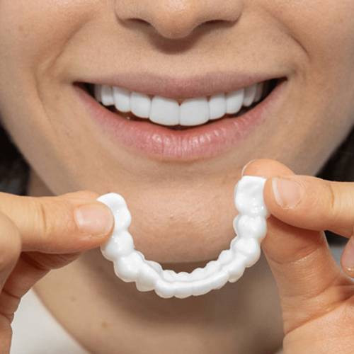 Monthly Payment Plan - Pop On Veneers with At Home Impression Kit