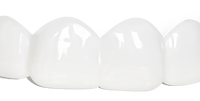 Pop On Veneers for Friends & Family with Impression Kit