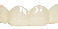 Pop On Veneers for Friends & Family with Impression Kit