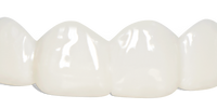 Pop On Veneers for Friends & Family with Impression Kit
