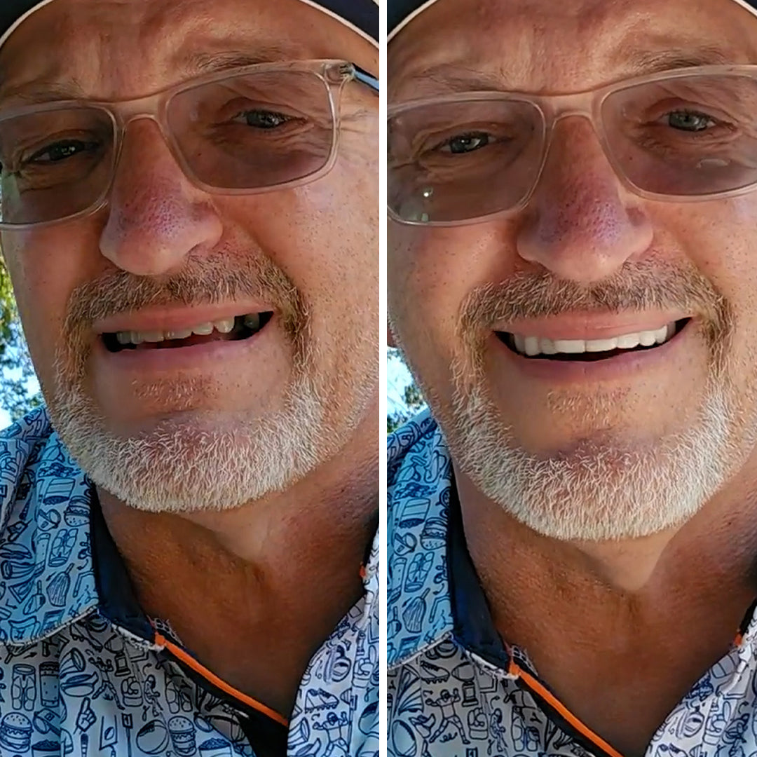 Love your smile again!