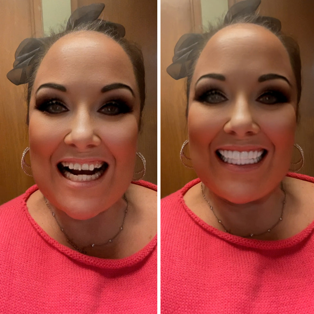 Ahora tengo una sonrisa perfecta.