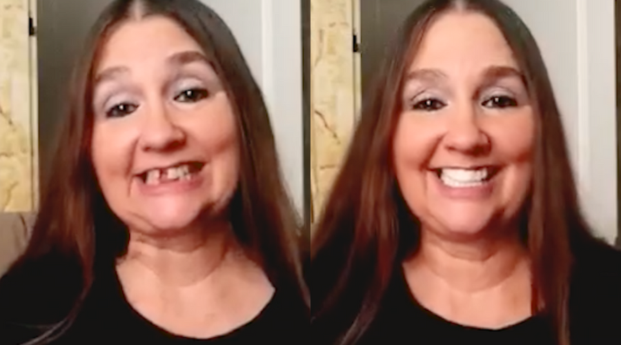 Amazing Smile Evolution!