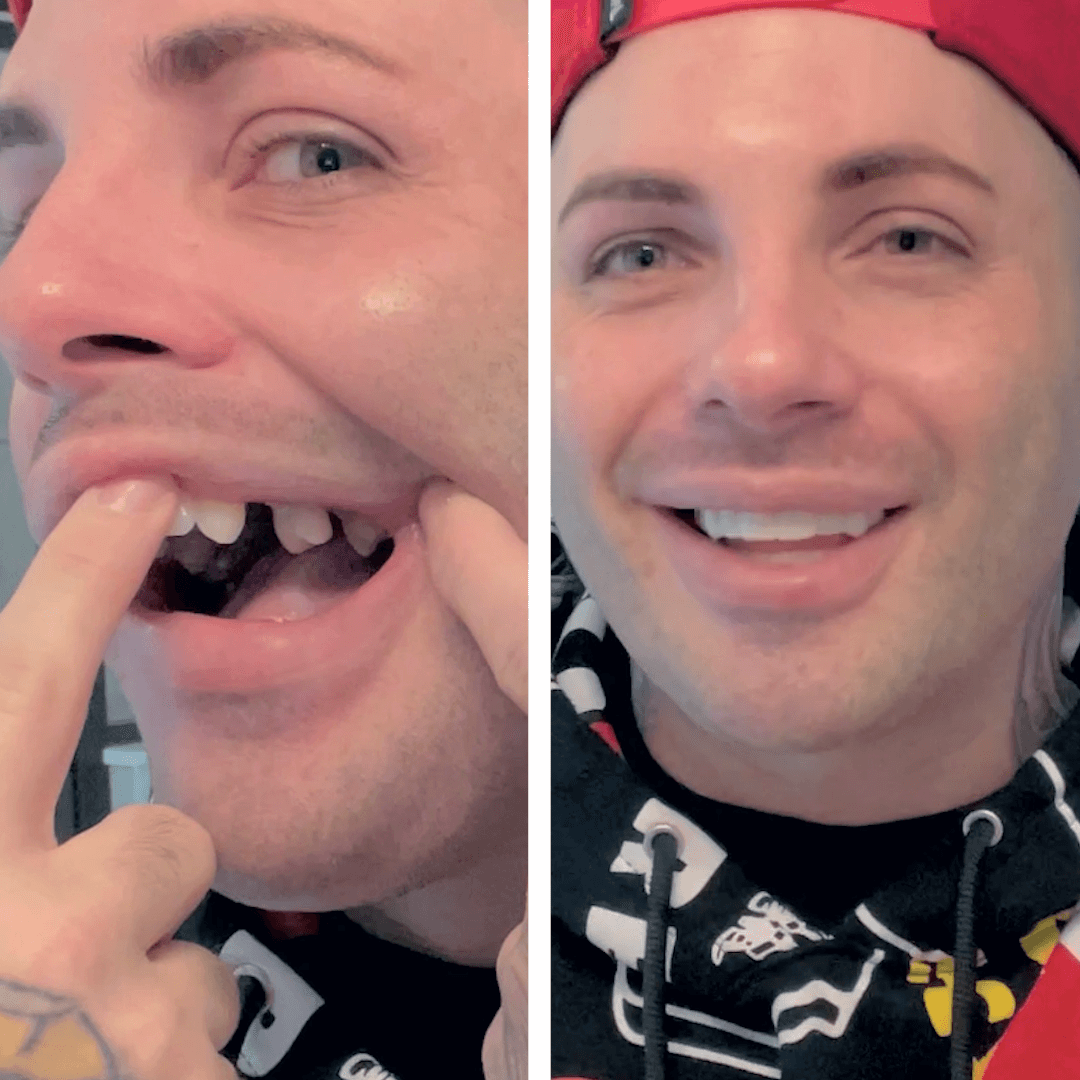 Ahora soy feliz con mi sonrisa.