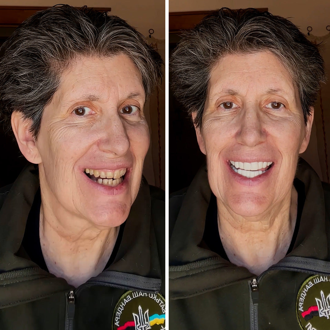 Sí, es así de fácil.