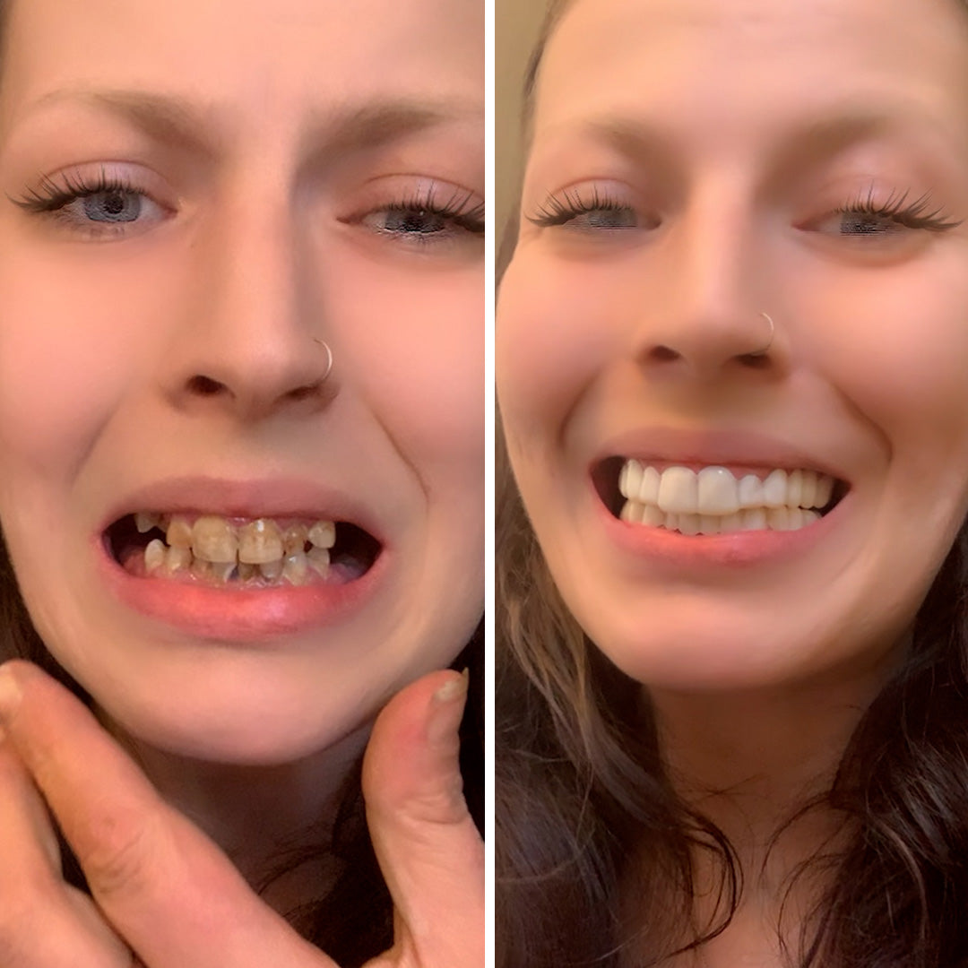 ¡Absolutamente obsesionada con mi nueva sonrisa!