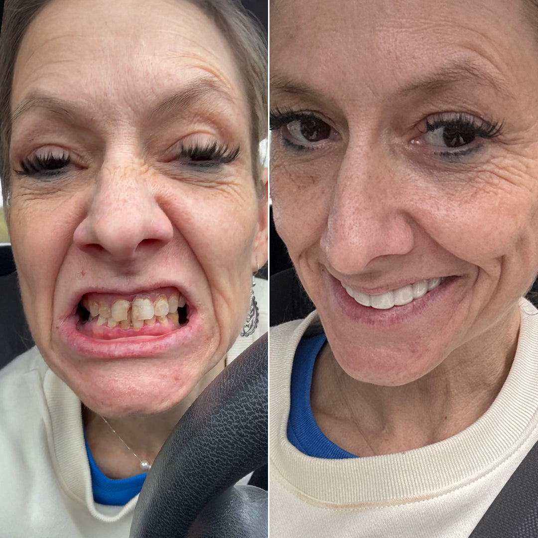 ¡Qué fácil es mejorar mi sonrisa!