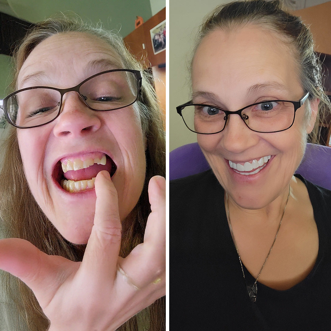 Me encanta mi sonrisa