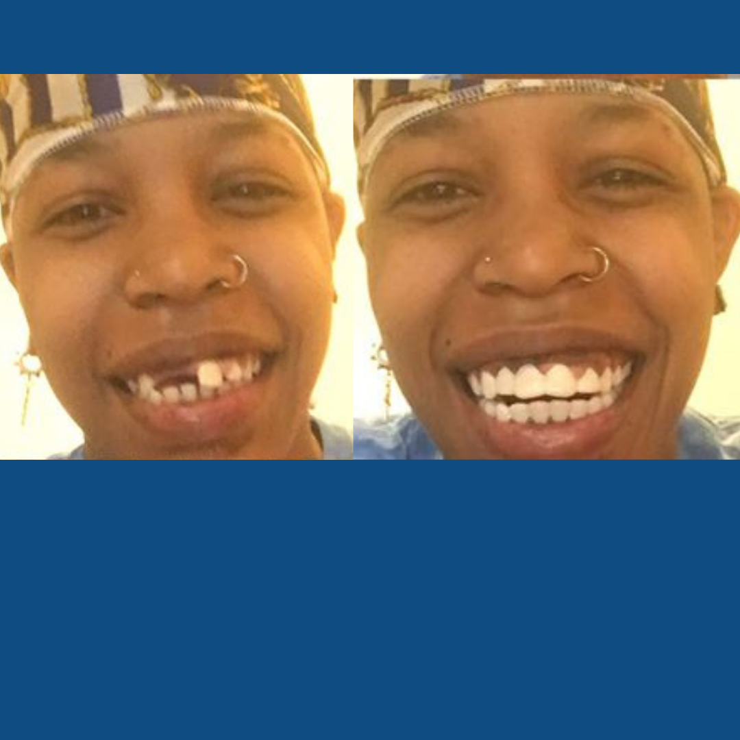 Ahora sonrío con confianza