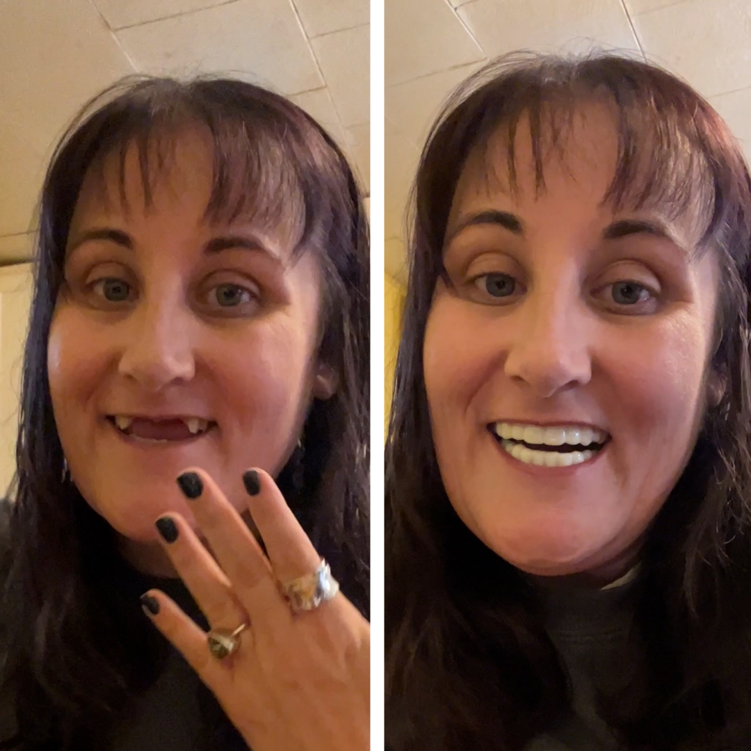 Estoy encantada de haber recuperado la sonrisa.