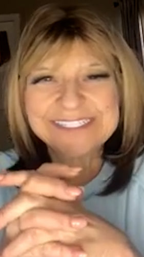 Las carillas Pop On son lo mejor.