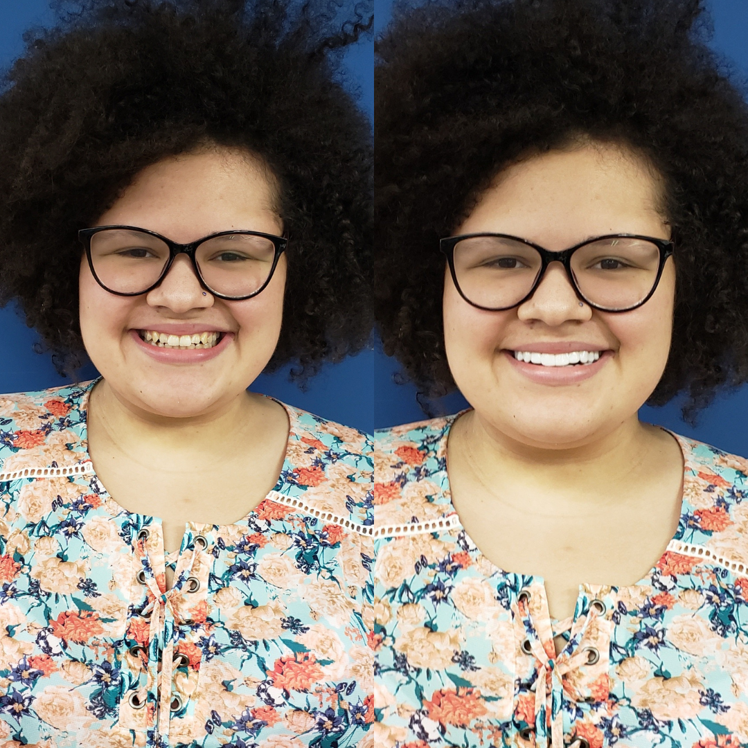 Hermosa sonrisa brillante