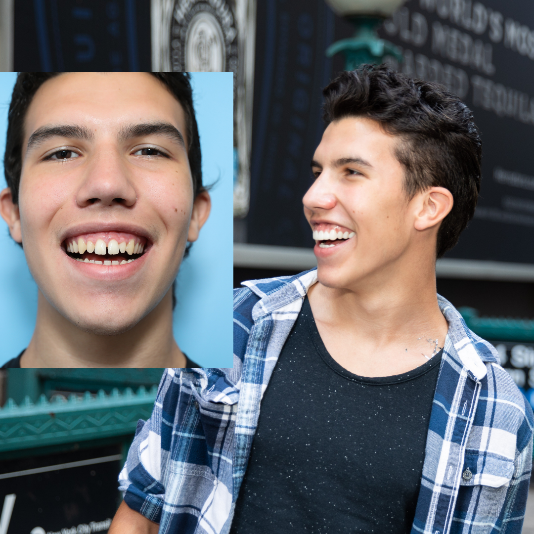 ¡Me encanta mi sonrisa!