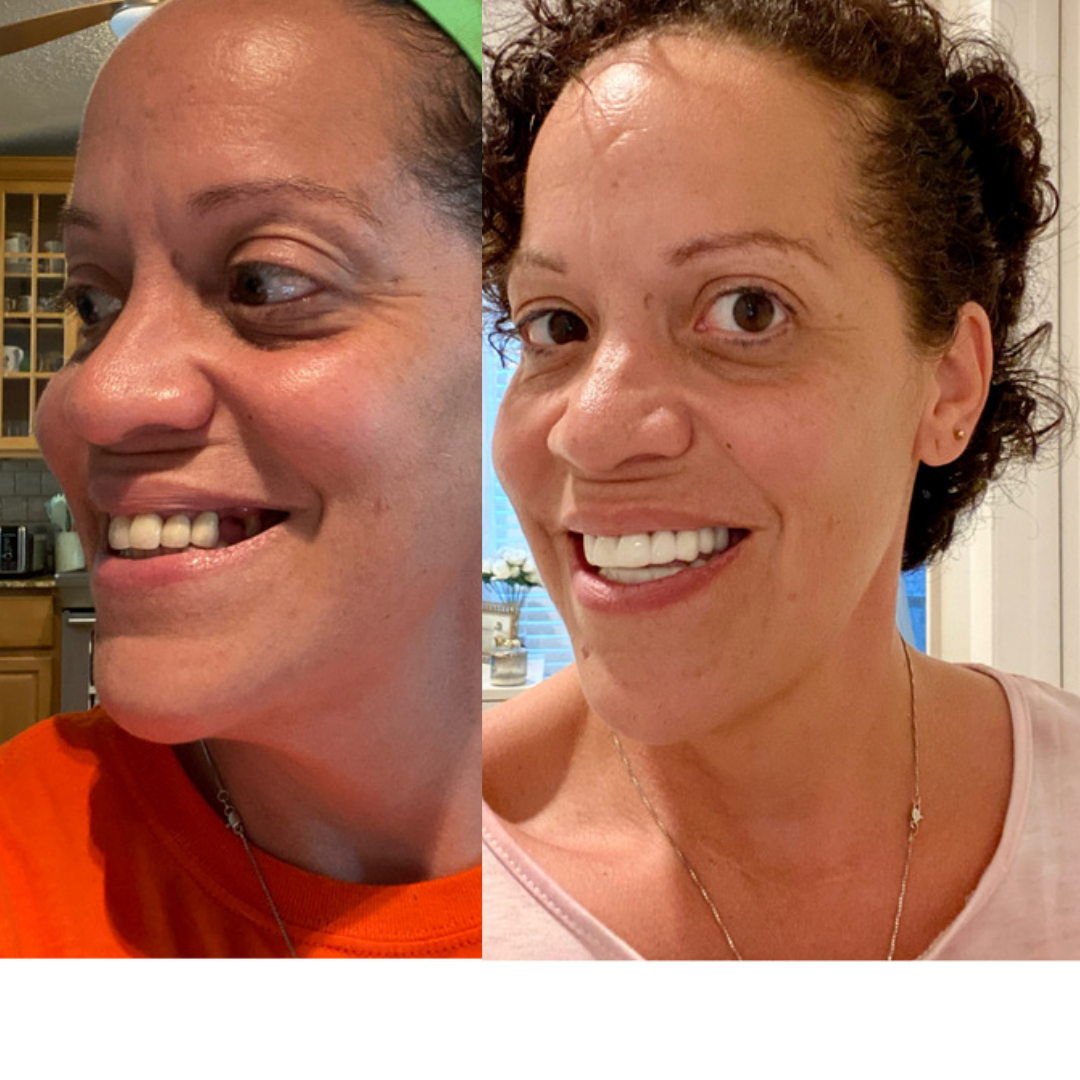 ¿Qué tan asombroso es eso?